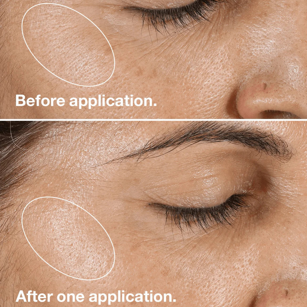 Clinique Clarifying Lotion – Facial Toner for Smooth, Refreshed & Balanced-Looking Skin