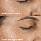 Clinique Clarifying Lotion – Facial Toner for Smooth, Refreshed & Balanced-Looking Skin