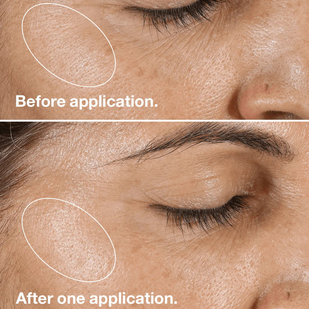 Clinique Clarifying Lotion – Facial Toner for Smooth, Refreshed & Balanced-Looking Skin