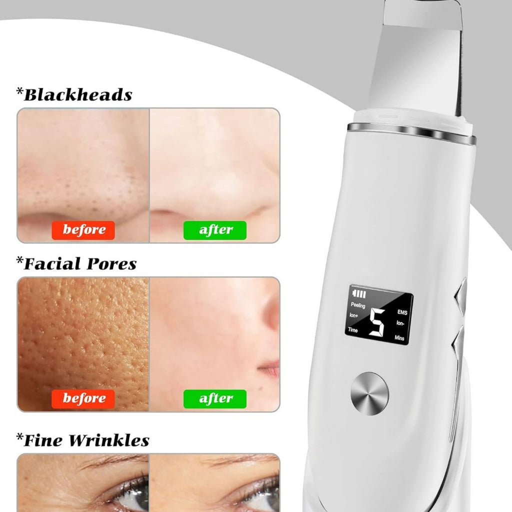 Skin Scrubber Face Spatula – 4-in-1 Facial Pore Cleaner & Blackhead Remover Tool with USB Charger