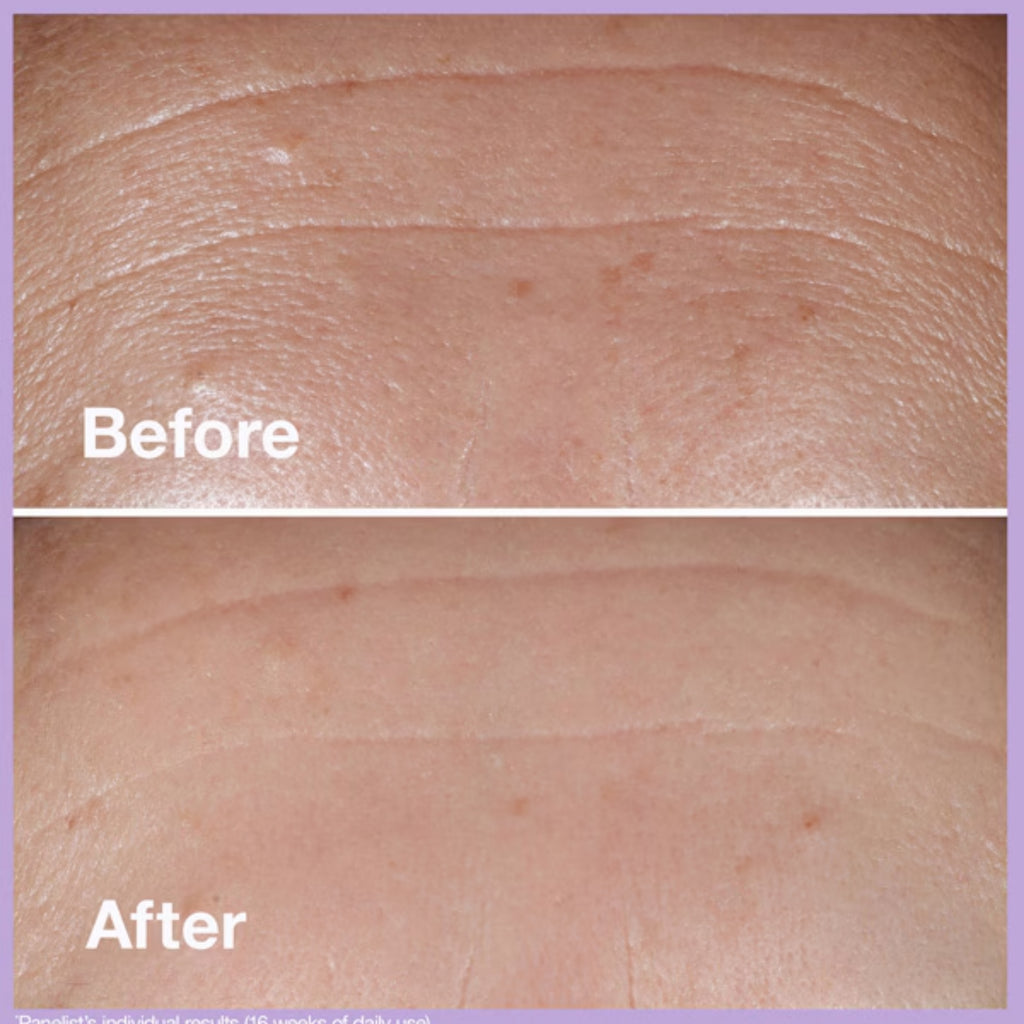 Clinique Smart SPF 15 Custom-Repair Moisturizer – Anti-Aging Face Moisturizer with SPF 15