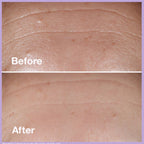 Clinique Smart SPF 15 Custom-Repair Moisturizer – Anti-Aging Face Moisturizer with SPF 15