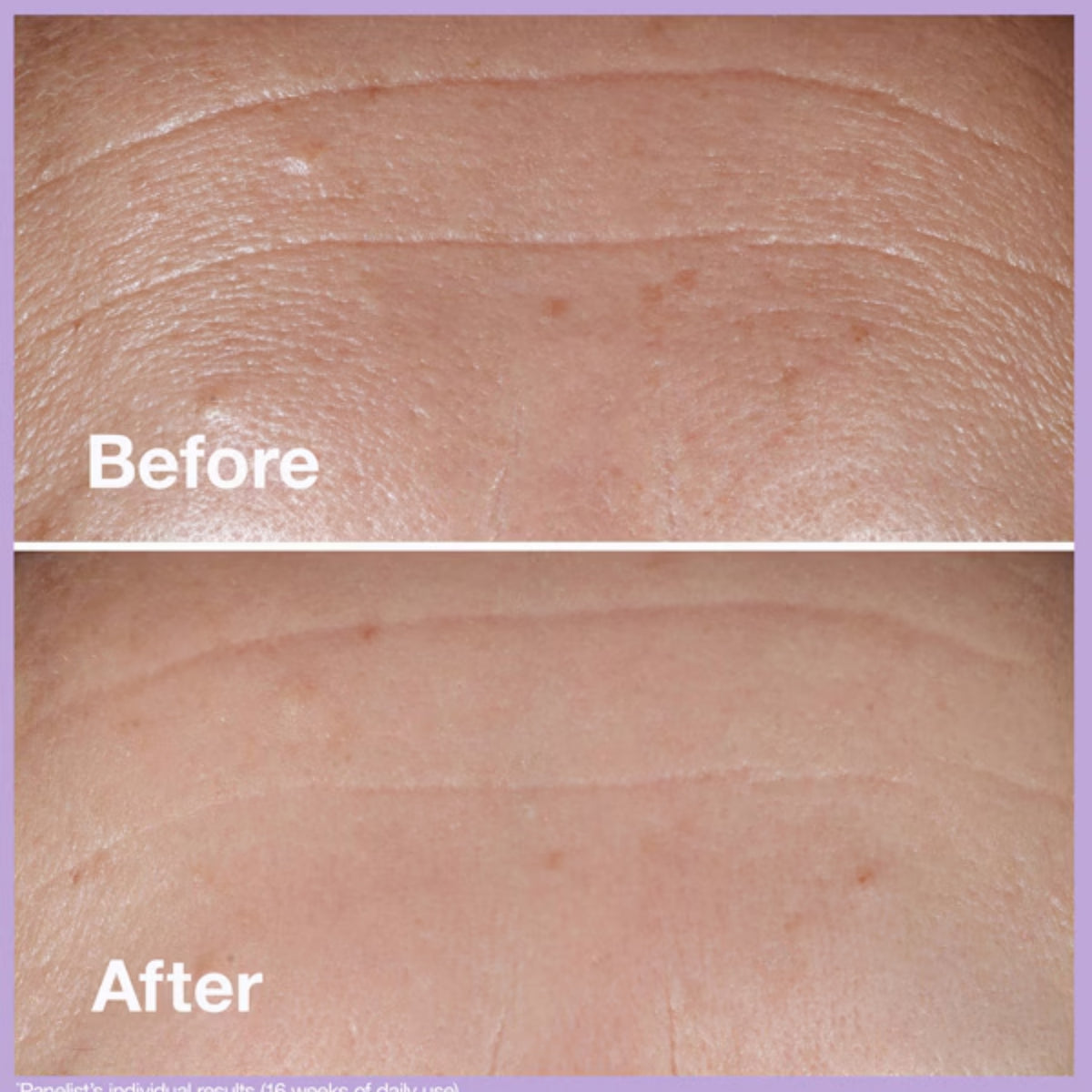 Clinique Smart SPF 15 Custom-Repair Moisturizer – Anti-Aging Face Moisturizer with SPF 15