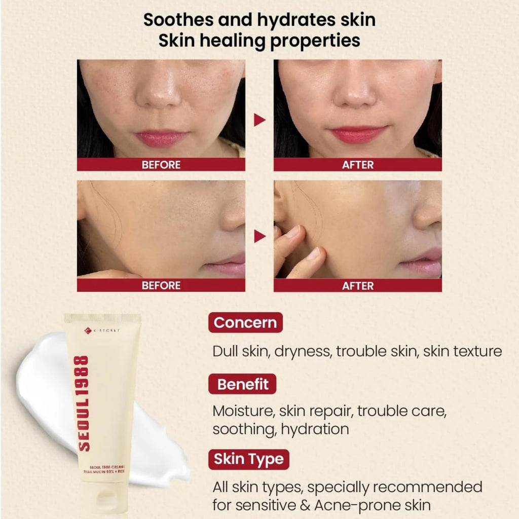 K-SECRET SEOUL 1988 Cream with 93% Snail Mucin + Rice – Hydrating Korean Face Cream