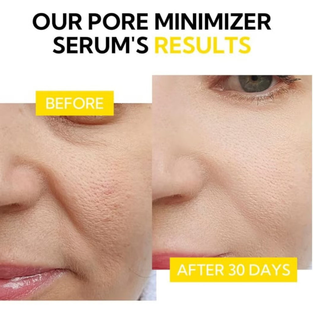 LANBENA Pore Solution Serum – Facial Serum for Pore Care, Hydration & Smooth-Looking Skin