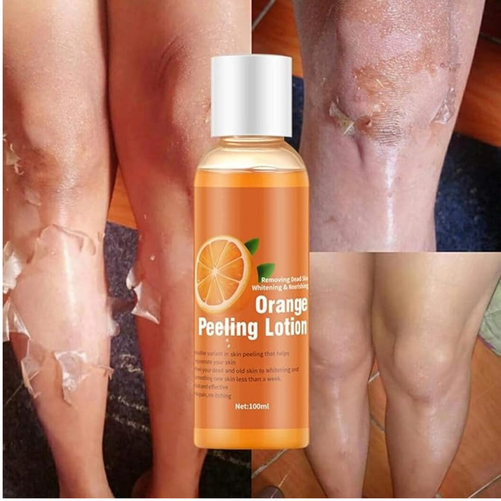 Orange Peeling Lotion – Brightening & Exfoliating Body Lotion for Smooth, Soft and Radiant-Looking Skin