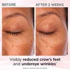 Elizabeth Arden Retinol + HPR Ceramide Skin Renewing Eye Cream 0.5 oz – Eye Cream for Fine Lines & Wrinkles