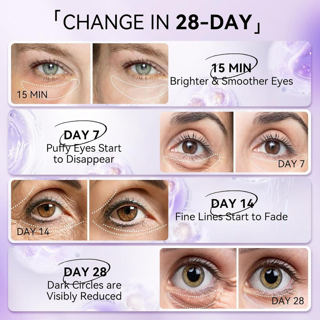 LANBENA Retinol Under Eye Patches – Cooling Hydra-Gel Eye Masks for Dark Circles, Puffy Eyes & Fine Lines, 30 Pairs