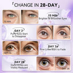 LANBENA Retinol Under Eye Patches – Cooling Hydra-Gel Eye Masks for Dark Circles, Puffy Eyes & Fine Lines, 30 Pairs