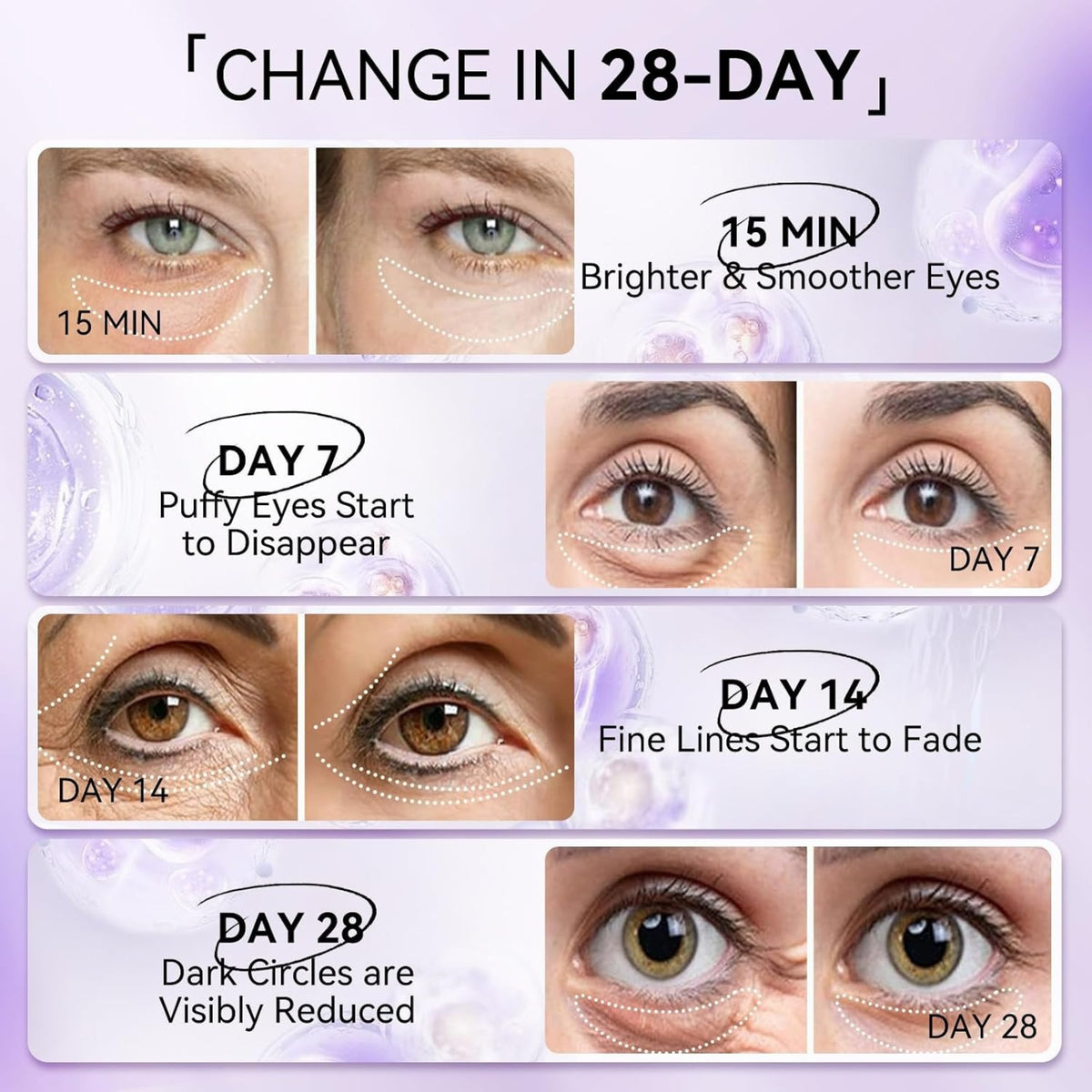 LANBENA Retinol Under Eye Patches – Cooling Hydra-Gel Eye Masks for Dark Circles, Puffy Eyes & Fine Lines, 30 Pairs