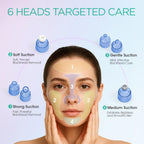 VOYOR Blackhead Remover Pore Vacuum – 6 Suction Heads Facial Pore Cleaner for Blackheads & Deep Cleansing